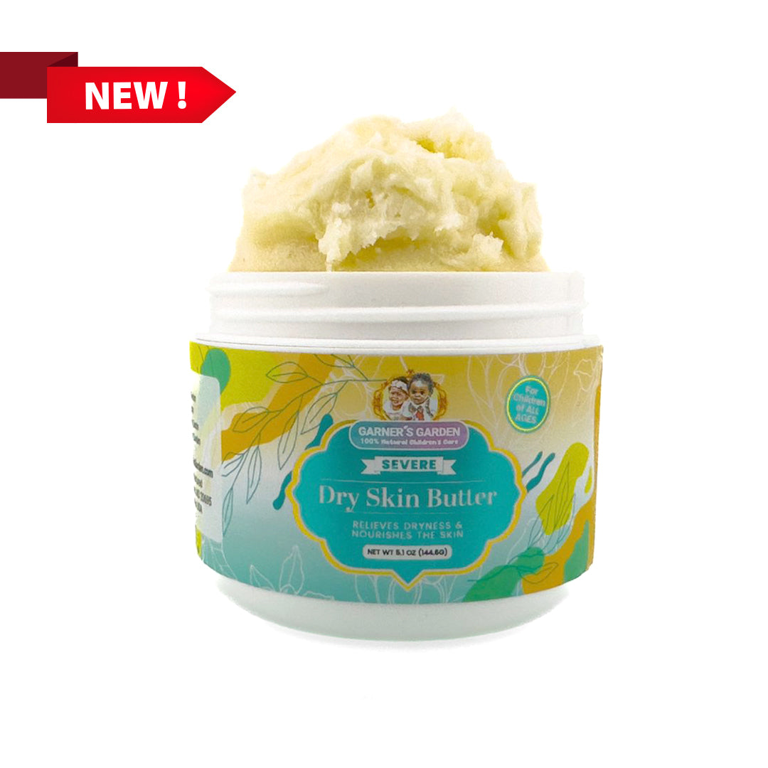 Severe Dry Skin Butter WS